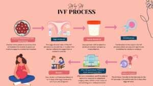 IVF Procedure Step By Step | The Complete IVF Process Guide