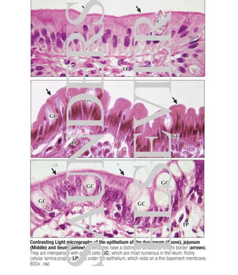 Contrasting Light Micrographs of the Epithelium of the Duodenum (Top ...