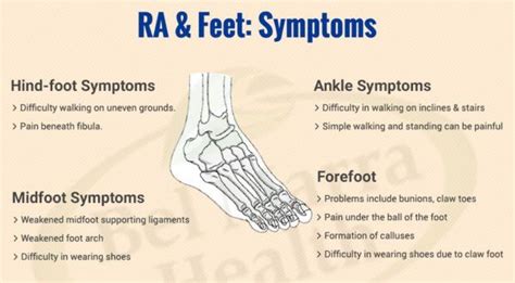 Osteoarthritis vs. Rheumatoid Arthritis Treatment > doctor Dwight Aged Bone