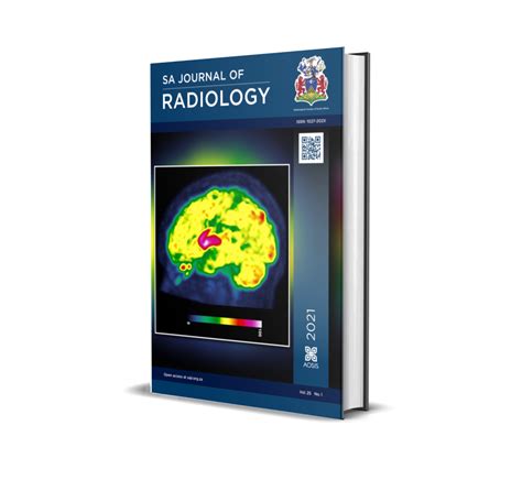 SA Journal of Radiology - AOSIS