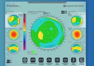 IVis Technologies: Secondary care - MedicalExpo