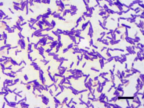 Clostridium Gram Stain