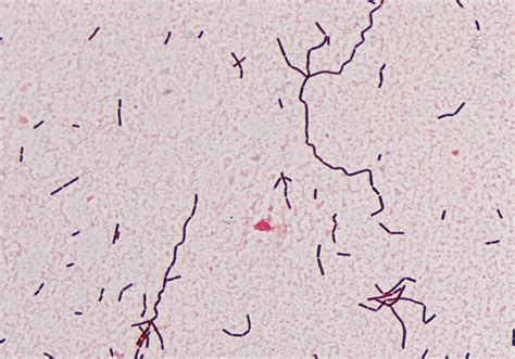 Streptococcus Lactis Gram Stain