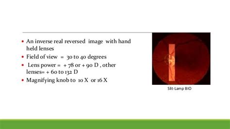 Fundus examination