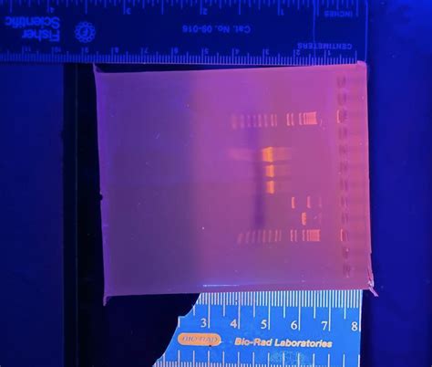 Solved 1Kb DNA Ladder up 6 12,000 65.000 10) 在2,000 61 650 E | Chegg.com