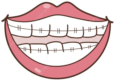 Teeth Braces Dentist Dental Beauty Mouth Fix Lip, Dental, Braces, Tooth Beauty PNG Transparent ...