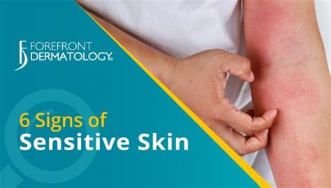 6 Signs You Have Sensitive Skin - Forefront Dermatology