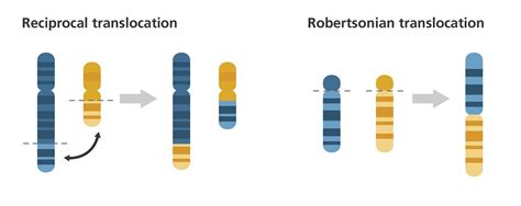 Chromosome translocation | Illustration showing translocatio… | Flickr