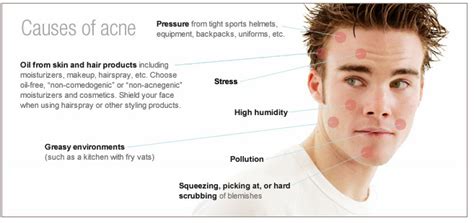 Health>Mind+Body: What Is Acne