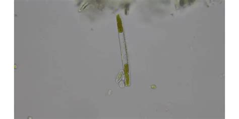 Diatoms: A Complete Overview – Microscope Clarity