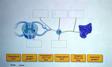 SOLVED: Preganglionic axon Somatic ganglion Preganglionic neuron cell body Postganglionic axon ...