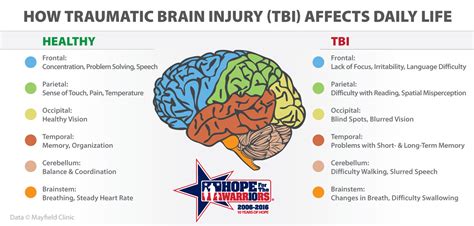 Hope For The Warriors®: The Daily Challenges of Traumatic Brain Injury (TBI)