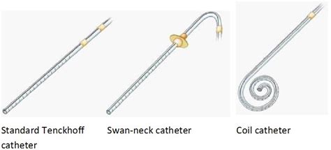 Peritoneal Dialysis Catheter Placement and Management | IntechOpen