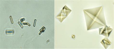 Different morphologies of crystals made of calcium oxalate dihydrate... | Download Scientific ...