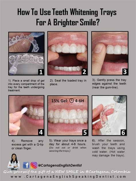 Custom Whitening Tray Instructions ⋆ HOW TO USE THEM?