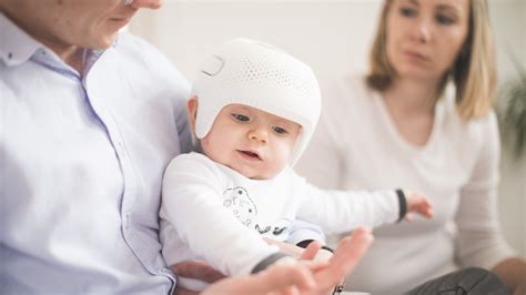 Identify & Measure Plagiocephaly | Parents Severity Scale