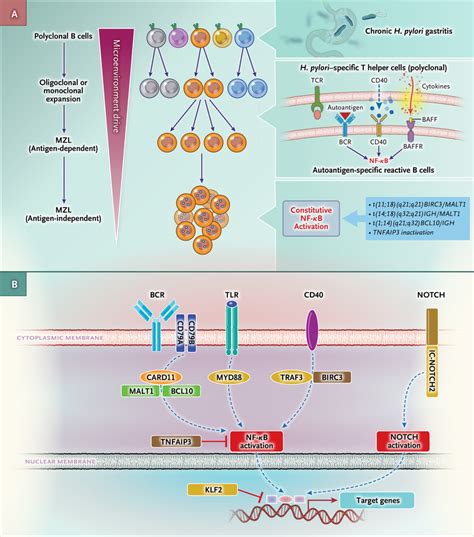 Marginal-Zone Lymphomas | NEJM