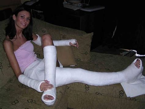 How to make a leg cast for halloween | ann's blog