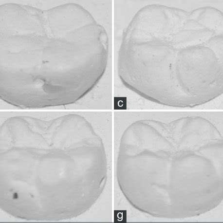 Identification of the cusps, seen from the occlusal surface of a first ...