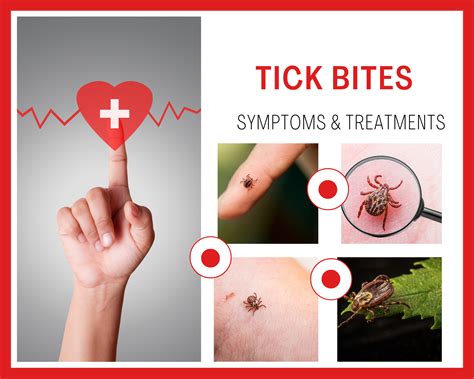 Tick Bites - Symptoms, treatment & prevention