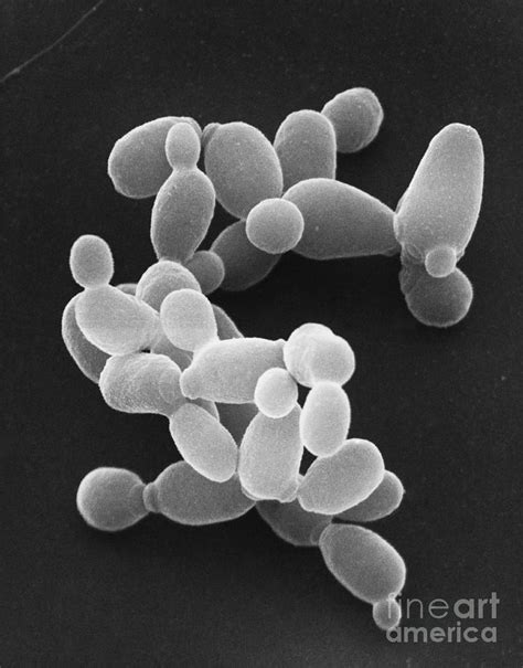 Saccharomyces Cerevisiae Electron Microscope