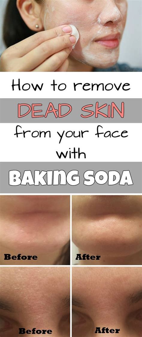 How to remove dead skin from your face with baking soda | Beauty hacks, Skin tips, Best beauty tips