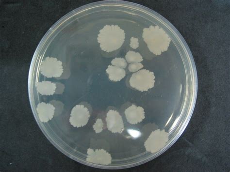 Bacillus subtilis1 | Bacillus, Bacillus subtilis, Microbiology