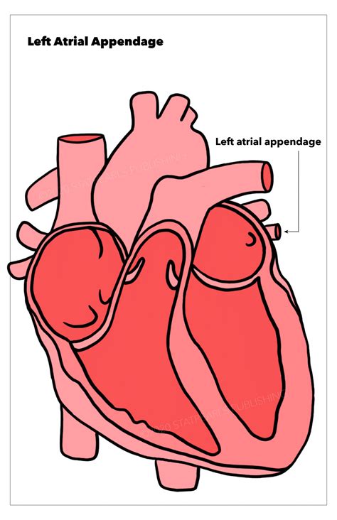 Anatomy, Thorax, Heart Left Atrial Appendage Article