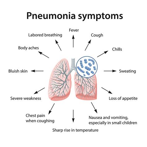 Your Ultimate Guide To Pneumonia In The Elderly - Aston Gardens