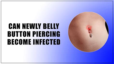 Can Newly Belly Button Piercing Become Infected After Years?