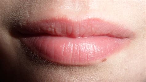 small white spots in lips | Ownerlip.co