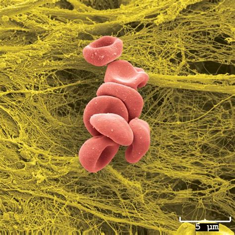 Scanning Electron Microscopy Images | Central Microscopy Research Facility