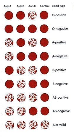 The Rh-Negative Registry - General Blood and Rh-Negative Information