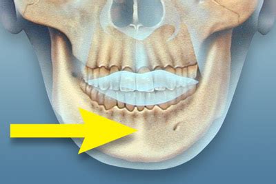 Symphysis Mandibular