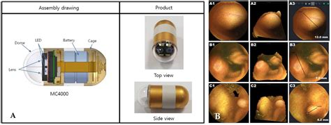 Diagnostics | Free Full-Text | Capsule Endoscopy: Pitfalls and ...