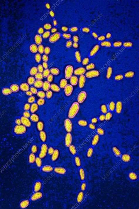 Enterococci bacteria, light micrograph - Stock Image - C058/4694 - Science Photo Library