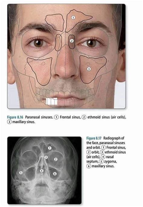 Facial Bones X-Ray | Medical Anatomy