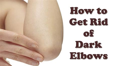 How to get rid of bone spur in elbow: Bone Spurs of the Elbow