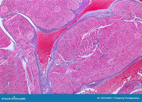 Histological Sample Heart Muscle Tissue Under the Microscope. Stock ...