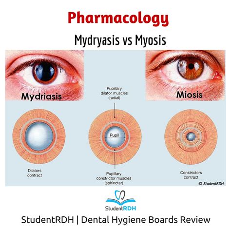 Q: The following drugs cause pupil dilation EXCEPT: - StudentRDH Blog