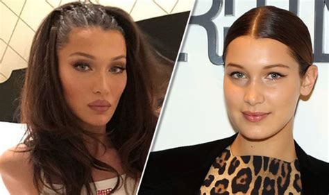 Bella Hadid before and after: Has she had surgery? An expert weighs in | Life | Life & Style ...