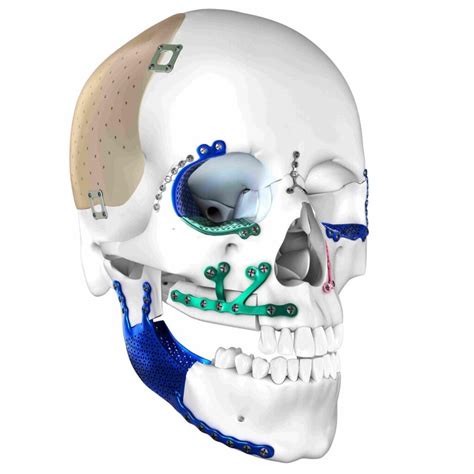 Best Craniofacial Trauma | Diagnosis | Dr. Changule's Face Clinic