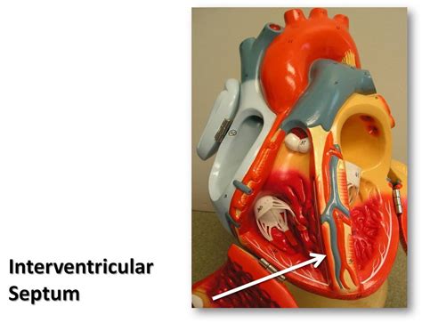 Interventricular septum - The Anatomy of the Heart Visual … | Flickr