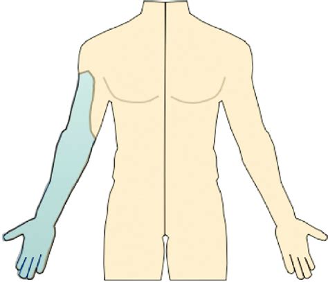 Axillary Nerve Block Anatomical Distribution. | Download Scientific Diagram