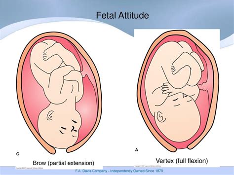 the fetal presentation is cephalic