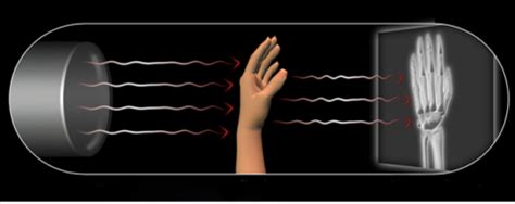 Properties of x-ray. - radiologystar