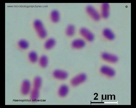 Haemophilus influenzae Gram stain. Haemophilus influenzae micrograph ...