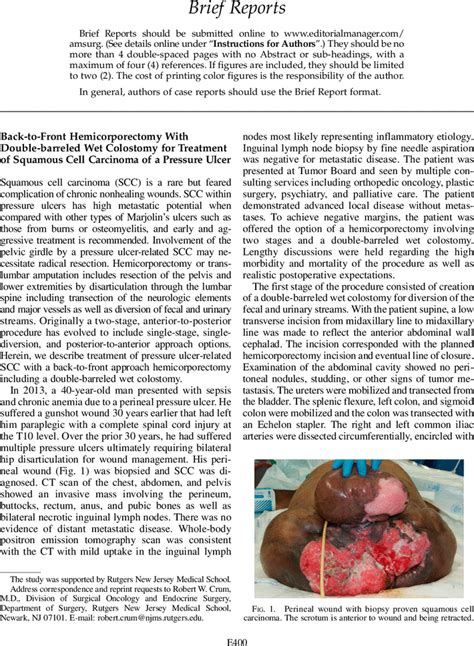 Back-to-Front Hemicorporectomy with Double-barreled Wet Colostomy for ...