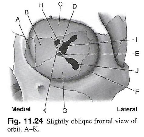 Orbit Bones Diagram | Quizlet