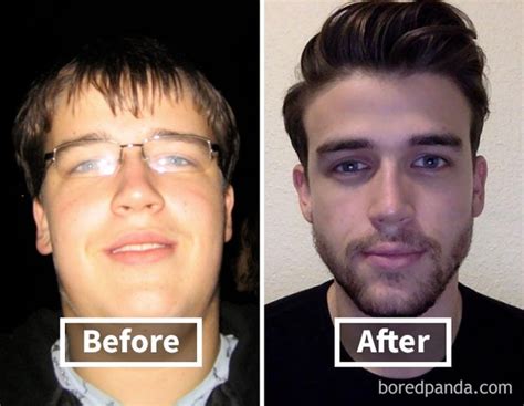 How To Slim Down Your Face And Improve Your Jawline | Justinboey